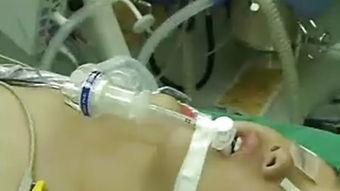 国产视频气管插管镜,引领医疗影像技术革新